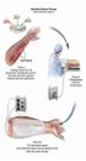 Repairing Injured Skin: Biologics, Skin Substitutes, and Scaffolds: Review
