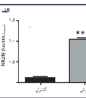The Effect of Exercise During Maternal Pregnancy on the Modulation of NR2B Gene Expression in the Brain of Newborn Rats