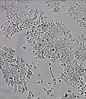 Investigating the Role of Tumor-Associated Macrophages in the Resistance of Brain Metastatic Tumor Cells to Paclitaxel in Two- Dimensional and Three-Dimensional Cell Culture Conditions