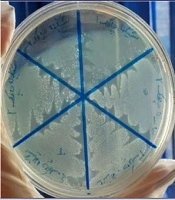 Investigating the Antibacterial Effect of Goose, Turkey, Natural and Artificial Chickens Egg White on Gram-Negative and Gram-Positive Bacteria In Vitro