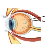 Optogenetics: A new approach for treatment of inherited retinal degeneration
