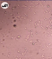 Preparation and Characterization of Polyethylene Oxide, Polyethylene Oxide-Gum Arabic, and Polyethylene Oxide-Gum Arabic-Menthol Nanofibers and Their Toxicity on Melanoma Cancer Cells and Healthy Human Skin