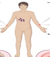 Clinical Manifestations, Transmission, Pathogenesis, Diagnosis, and Management of Dengue Fever: A Comprehensive Review