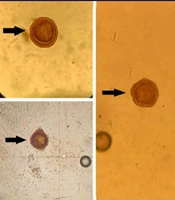 Investigation of Soil Contamination with Toxocara Eggs in Public Parks of Semnan Province