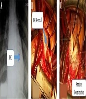 Cover image of the article: Highlights from the First Bi-monthly Virtual Meeting of Iranian Society of Cardiac Surgeons During COVID-19 Outbreak