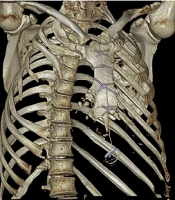 Multidiscip Cardio Annal