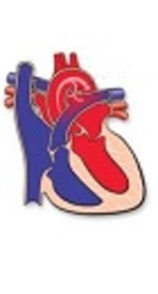 Shone’s Syndrome and Patent Ductus Arteriosus: A Rare Case Report