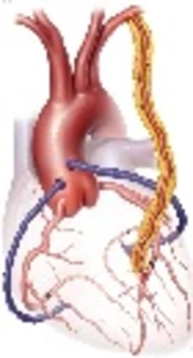 Association of Perioperative Serum Sodium Level Fluctuation and Postoperative Complications in Coronary Artery Bypass Graft Surgery