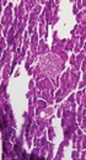 Protective Effects of Quercetin on Hyperglycemia and Stress Proteins Expression in Rats with Streptozocin-Induced Diabetes