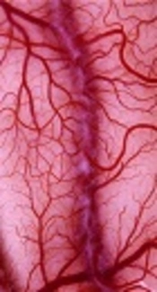 The Angiogenetic Effect of Resveratrol on Dermal Wound Healing in Balb/C Mice