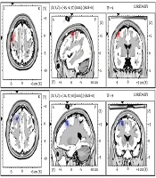 Cover image of the article: A Novel Combined Treatment for Relapse Prevention of Depression: A Case Report