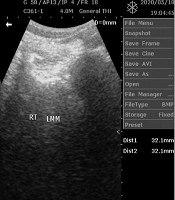 The Effect of Physical Activity Level and Body Adiposity on Fatty Infiltration of the Lumbar Multifidus in Apparently Healthy Individuals From an Urban African Setting