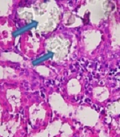 Effect of Hard Water on the Prevention and Treatment of Calcium Oxalate Nephrolithiasis in Rats