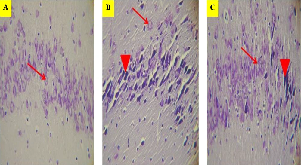 Photomicrograph showing pyramidal cell layer in CA1 region of the hippocampus in Saline + saline (A), Scopolamine + saline (B), and Scopolamine + aminoguanidine groups (C). The normal pyramidal cells showing a prominent nucleolus, lightly colored cytoplasm, and a well-defined nuclear membrane. The shrunken pyramidal cells with a dark cytoplasm, irregular boundaries, and pyknotic nucleus indicating neurodegeneration. The arrows indicate the normal pyramidal cells, and arrow heads indicate shrunken pyramidal cells. (Cresyl Violet staining, magnification ×400). Photomicrograph showing pyramidal cell layer in CA1 region of the hippocampus in Saline + saline (A), Scopolamine + saline (B), and Scopolamine + aminoguanidine groups (C). The normal pyramidal cells showing a prominent nucleolus, lightly colored cytoplasm, and a well-defined nuclear membrane. The shrunken pyramidal cells with a dark cytoplasm, irregular boundaries, and pyknotic nucleus indicating neurodegeneration. The arrows indicate the normal pyramidal cells, and arrow heads indicate shrunken pyramidal cells. (Cresyl Violet staining, magnification ×400).
