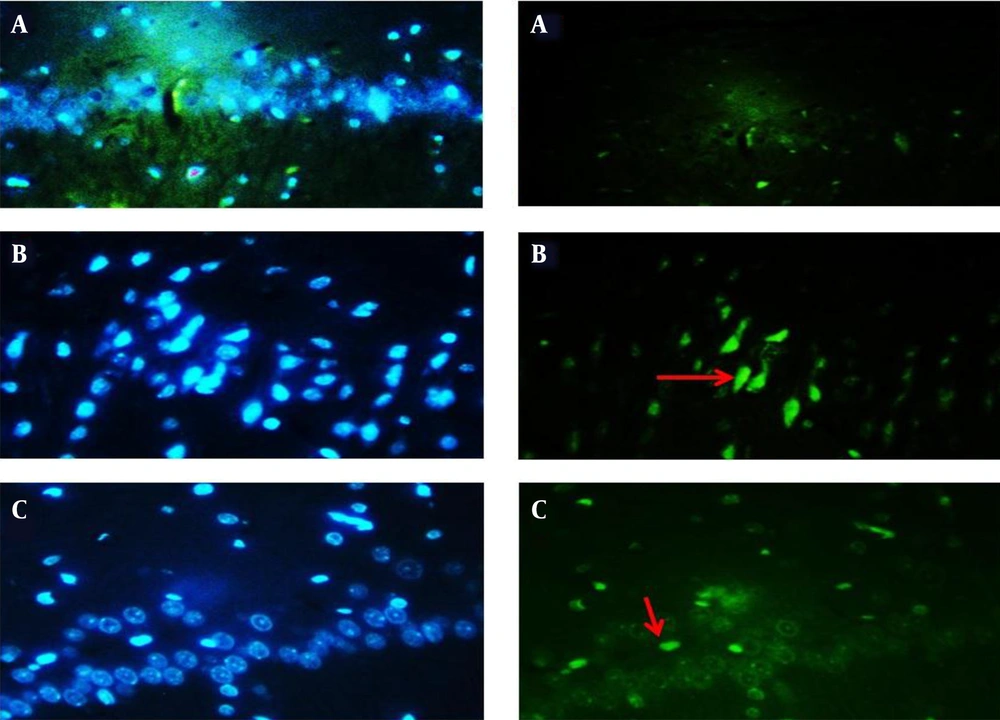Effect of scopolamine (3 mg/kg) and aminoguanidine (100 mg/kg) on apoptosis (cell death) in cells of the hippocampal CA1 region. TUNEL-positive cells in: Saline + saline (A), Scopolamine + saline (B), and Scopolamine + aminoguanidine groups (C). Green color indicates positive TUNEL cells in each group. The arrows indicate TUNEL-positive cells. (TUNEL staining, magnification ×200). Effect of scopolamine (3 mg/kg) and aminoguanidine (100 mg/kg) on apoptosis (cell death) in cells of the hippocampal CA1 region. TUNEL-positive cells in: Saline + saline (A), Scopolamine + saline (B), and Scopolamine + aminoguanidine groups (C). Green color indicates positive TUNEL cells in each group. The arrows indicate TUNEL-positive cells. (TUNEL staining, magnification ×200).