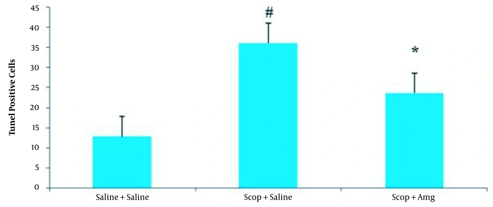 Comparison of TUNEL-positive cells (amount of cell death) in rat CA1 cells in the Saline + saline, scopolamine + saline, and scopolamine + aminoguanidine groups. Values are shown as mean ± SEM. Ten animals in each group. # P < 0.05: Compared to saline + saline group; * P < 0.05: Compared to Scopolamine + saline group. Comparison of TUNEL-positive cells (amount of cell death) in rat CA1 cells in the Saline + saline, scopolamine + saline, and scopolamine + aminoguanidine groups. Values are shown as mean ± SEM. Ten animals in each group. # P < 0.05: Compared to saline + saline group; * P < 0.05: Compared to Scopolamine + saline group.