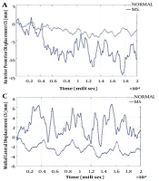 Validation of the BESTest for Measuring Balance in People with Multiple Sclerosis