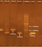 Molecular Investigation of Enterotoxigenic Staphylococcus aureus Isolates from Restaurant Staff