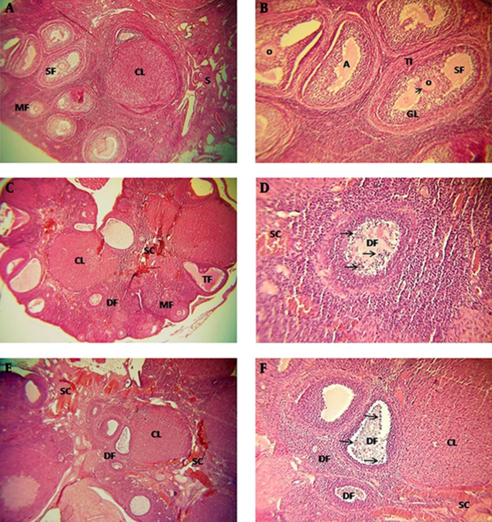 Light Micrographs of the Ovarian Structure in the Different Groups A and B, In the sham group, some types of follicles, corpus luteum, and atretic foliclles are observed. C and D, In the SCI group (14th day after SCI), types of follicles are observed and atretic foliclles increased, also heterogeneous and stromal congestion including inflamatory cells are abvious. E and F, In the SCI group (21th day after SCI), types of degenerative follicles and stromal congestion are observed, also increase of inflammatory cells and heterogeneous stroma are observed. SC, Stromal Congestion; DF, Degenerative Follicles; CL, Corpus Luteum; O, Oocyte; MF, Multilaminar Primary Follicles; SF, Secondary Follicles. Apoptotic cells (arrows), zona pellocida (arrowhead), H and E staining, magnification 40× and 100×.