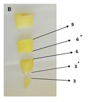 Comparative Evaluation of Dentinal Microcrack Using M3 ProGold, Mtwo Rotary File and Hand File in Root Canal Therapy: An In-Vitro Study