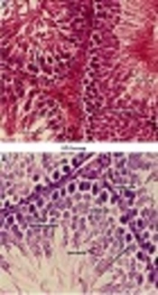 Cover image of the article: WITHDRAWN: Improvement of Sexual Parameters with Tribulus terrestris and Anacyclus pyrethrum Treatment in Male Rats