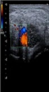 Basics of Ultrasound for Musculoskeletal Evaluation in the Rehabilitation Settings: Review of the Literature