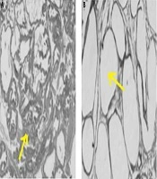 The Effects of Eight Weeks of Aerobic Training and Green Tea Extract Consumption on Some Angiogenesis and Metastasis Markers in Prostate Cancer-Induced Rats