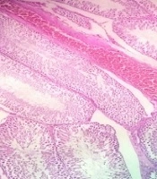 Effects of Chronic Use of Methylphenidate on Spermatogenesis and Sexual Hormones in Adult Male Rats