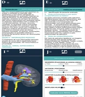 Application for Tridimensional Renal Visualization and Operative Planning