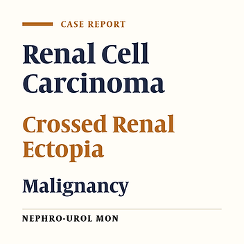 Unusual Presentation of Renal Cell Carcinoma in Crossed Ectopic Kidney