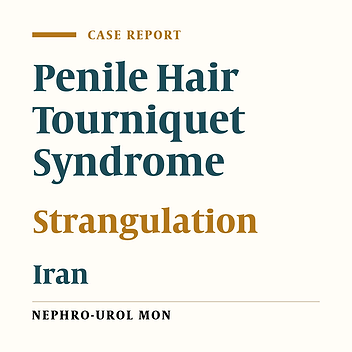 Penile Hair Tourniquet Syndrome Due to a Coil of Hair: First Report in Iran