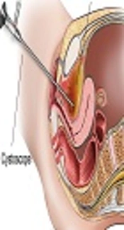 Cover image of the article: Cystoscopy Findings in Females with Recurrent Urinary Tract Infection