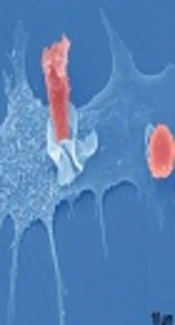 Effect of Cytomegalovirus Exposure on the Atherosclerotic Events Among Kidney-Transplanted Patients, A Systematic Review and Meta-Analysis