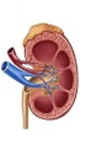 Etiology of Hydronephrosis in Neonates