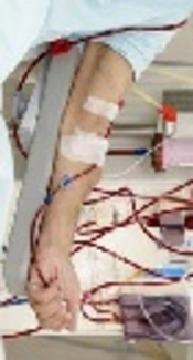 Comparison of Body Composition Assessed by Multi-Frequency Segmental Bioelectrical Impedance Analysis and Dual Energy X-Ray Absorptiometry in Hemodialysis Patients