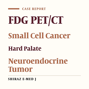 Primary Small-Cell Carcinoma of the Hard Palate: An Extremely Rare Occasion