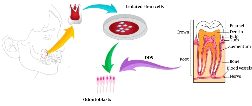 Steps of odontoblast differentiation by dentin derivative signal (DDS) dental stem cells isolated from pulp of extracted tooth, dentin layer prepared for DDS making, then dental pulp stem cells exposed to DDS, after three days odontoblasts formed and dentin secretion was seen. Steps of odontoblast differentiation by dentin derivative signal (DDS) dental stem cells isolated from pulp of extracted tooth, dentin layer prepared for DDS making, then dental pulp stem cells exposed to DDS, after three days odontoblasts formed and dentin secretion was seen.