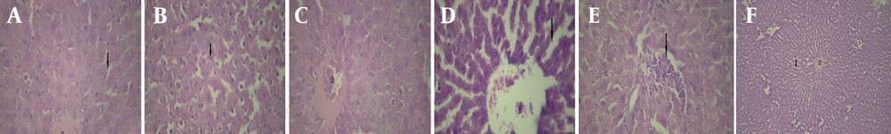 Light photomicrographs of the liver; A, control group: shows a central vein (star) with hepatocytes arranged in cords. Cords of hepatocytes enclose blood sinusoids (arrow) (H&E, X400). B, tacrolimus-treated group: some hepatocytes show dark nuclei and dense acidophilic cytoplasm (arrow) (H&E, X400). C, tacrolimus-treated group: dilated and congested central veins (star) (H&E, X400). D, tacrolimus-treated group: dilated sinusoids with increased proliferation of Kupffer cells (arrow) (H&E, X400). E, tacrolimus-treated group: shows lymphocytic infiltration and mild inflammatory areas (arrows) (H&E, X400). F, tacrolimus + EA group: shows a normal central vein (star) without congestion and ameliorated cords of hepatocytes enclosing blood sinusoids (arrow) (H&E, X100). Light photomicrographs of the liver; A, control group: shows a central vein (star) with hepatocytes arranged in cords. Cords of hepatocytes enclose blood sinusoids (arrow) (H&E, X400). B, tacrolimus-treated group: some hepatocytes show dark nuclei and dense acidophilic cytoplasm (arrow) (H&E, X400). C, tacrolimus-treated group: dilated and congested central veins (star) (H&E, X400). D, tacrolimus-treated group: dilated sinusoids with increased proliferation of Kupffer cells (arrow) (H&E, X400). E, tacrolimus-treated group: shows lymphocytic infiltration and mild inflammatory areas (arrows) (H&E, X400). F, tacrolimus + EA group: shows a normal central vein (star) without congestion and ameliorated cords of hepatocytes enclosing blood sinusoids (arrow) (H&E, X100).