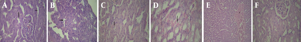 Light photomicrographs of the kidney; A, control group: normal renal glomeruli (star), proximal convoluted tubules (thick arrow), and distal tubules (thin arrow) (H&E, X400). B, tacrolimus-treated group: some tubules with necrotic and damaged epithelial cells (arrow) (H&E, X400). C, tacrolimus-treated group: hyaline casts in some tubules (arrow) (H&E, X400). D and E, tacrolimus-treated group: hemorrhage in the tubules (arrow) and congestion (star) (H&E, X400 and X100). F, tacrolimus + EA group: shows normal renal glomeruli and tubules without congestion or damaged cells (H&E, X400). Light photomicrographs of the kidney; A, control group: normal renal glomeruli (star), proximal convoluted tubules (thick arrow), and distal tubules (thin arrow) (H&E, X400). B, tacrolimus-treated group: some tubules with necrotic and damaged epithelial cells (arrow) (H&E, X400). C, tacrolimus-treated group: hyaline casts in some tubules (arrow) (H&E, X400). D and E, tacrolimus-treated group: hemorrhage in the tubules (arrow) and congestion (star) (H&E, X400 and X100). F, tacrolimus + EA group: shows normal renal glomeruli and tubules without congestion or damaged cells (H&E, X400).