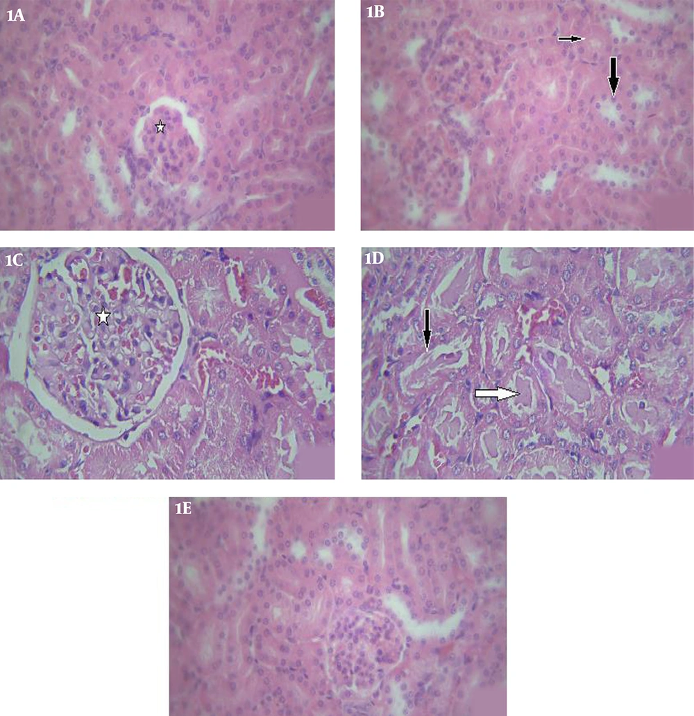 Light photomicrographs of the kidney. 1A, control group: normal renal glomeruli (star) (H&E, X100); 1B, proximal convoluted tubules (thin arrow), distal tubules (thick arrow) (H&E, X100); 1C, Iron oxide treated group: glomerular destruction and congestion (star) (H&E, X400); 1D, iron oxide treated group: showing hyaline casts (black arrow), in some tubules and some tubules with damaged epithelial cells (white arrow) (H&E, X400); 1E, Iron oxide+ S.platensis group: shows normal renal glomeruli and tubules, without any congestion or damaged cells (H&E, X100). Light photomicrographs of the kidney. 1A, control group: normal renal glomeruli (star) (H&E, X100); 1B, proximal convoluted tubules (thin arrow), distal tubules (thick arrow) (H&E, X100); 1C, Iron oxide treated group: glomerular destruction and congestion (star) (H&E, X400); 1D, iron oxide treated group: showing hyaline casts (black arrow), in some tubules and some tubules with damaged epithelial cells (white arrow) (H&E, X400); 1E, Iron oxide+ S.platensis group: shows normal renal glomeruli and tubules, without any congestion or damaged cells (H&E, X100).