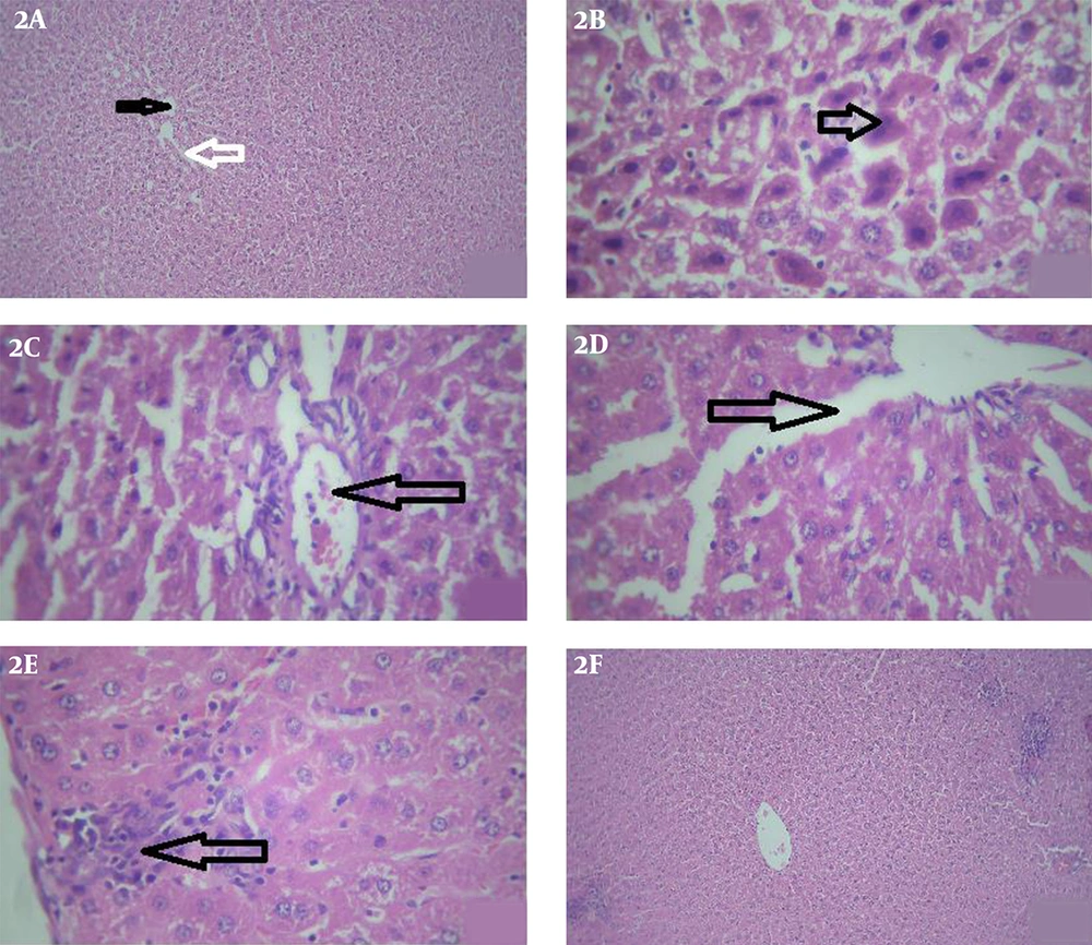 Light photomicrographs of the liver. 2A, control group: shows a central vein (black star) with hepatocyte arranged in cords. Cords of hepatocytes enclose blood sinusoids (white arrow) (H&E, X40). 2B, iron oxide treated group: some hepatocytes show dark nuclei and dense acidophilic cytoplasm (arrow) (H&E, X400). 2C, iron oxide treated group: dilated and congested central veins (arrow) (H&E, X400). 2D, iron oxide treated group: dilated sinusoids (arrow) (H&E, X400). 2E, iron oxide treated group: shows lymphocytic infiltration and mild inflammatory areas (arrows) (H&E, X400). 2F, iron oxide+ S.Platensis group: shows normal central vain without any congestion and ameliorated cords of hepatocytes enclose blood sinusoids (H&E, X40). Light photomicrographs of the liver. 2A, control group: shows a central vein (black star) with hepatocyte arranged in cords. Cords of hepatocytes enclose blood sinusoids (white arrow) (H&E, X40). 2B, iron oxide treated group: some hepatocytes show dark nuclei and dense acidophilic cytoplasm (arrow) (H&E, X400). 2C, iron oxide treated group: dilated and congested central veins (arrow) (H&E, X400). 2D, iron oxide treated group: dilated sinusoids (arrow) (H&E, X400). 2E, iron oxide treated group: shows lymphocytic infiltration and mild inflammatory areas (arrows) (H&E, X400). 2F, iron oxide+ S.Platensis group: shows normal central vain without any congestion and ameliorated cords of hepatocytes enclose blood sinusoids (H&E, X40).