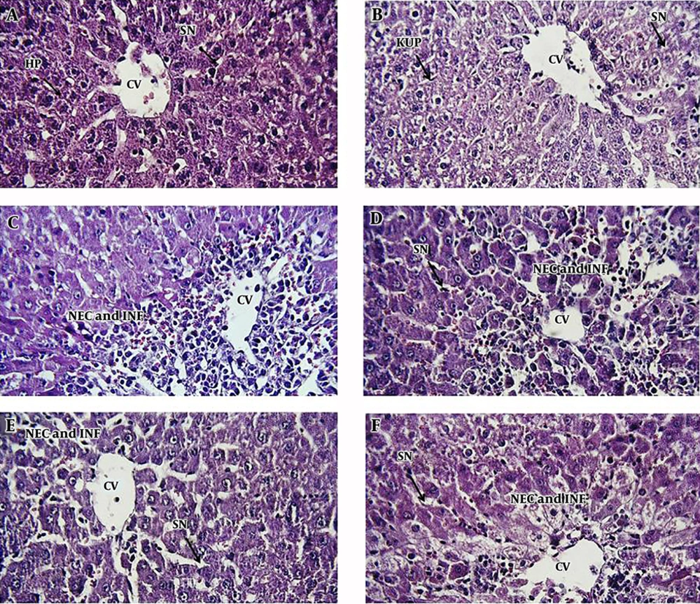 Photomicrographs of rat liver tissue in different groups: A, negative control group; B, AhME control group; C, acetaminophen (APAP; 2 g/kg); D, AhME (50 mg/kg) + APAP (2 g/kg); E, AhME (100 mg/kg) + APAP (2 g/kg); F, AhME (200 mg/kg) + APAP (2 g/kg). Original magnification of all images is 40×. CV, central vein; HP, hepatocyte; SN, sinusoid; KUP, kupffer cells; NEC, necrosis; INF, infiltration. Photomicrographs of rat liver tissue in different groups: A, negative control group; B, AhME control group; C, acetaminophen (APAP; 2 g/kg); D, AhME (50 mg/kg) + APAP (2 g/kg); E, AhME (100 mg/kg) + APAP (2 g/kg); F, AhME (200 mg/kg) + APAP (2 g/kg). Original magnification of all images is 40×. CV, central vein; HP, hepatocyte; SN, sinusoid; KUP, kupffer cells; NEC, necrosis; INF, infiltration.