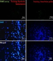 The Effect of Resistance Training and Phoenix dactylifera L. Extract on DRP1 and MFN1 Protein Expression, and the Apoptotic Status of Rat Liver: A Safe Alternative to Testosterone Injection