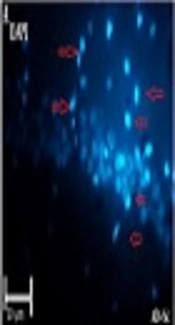 Evaluation of Aβ Deposits in the Hippocampus of a Rat Model of Alzheimer’s Disease After Intravenous Injection of Human Adipose Derived Stem Cells by Immuno- and Thioflavin S-Costaining