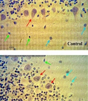 Evaluating the Effects of Aloe vera Gel on Cerebellum Histomorphometrical Changes in Diabetic Male Rats
