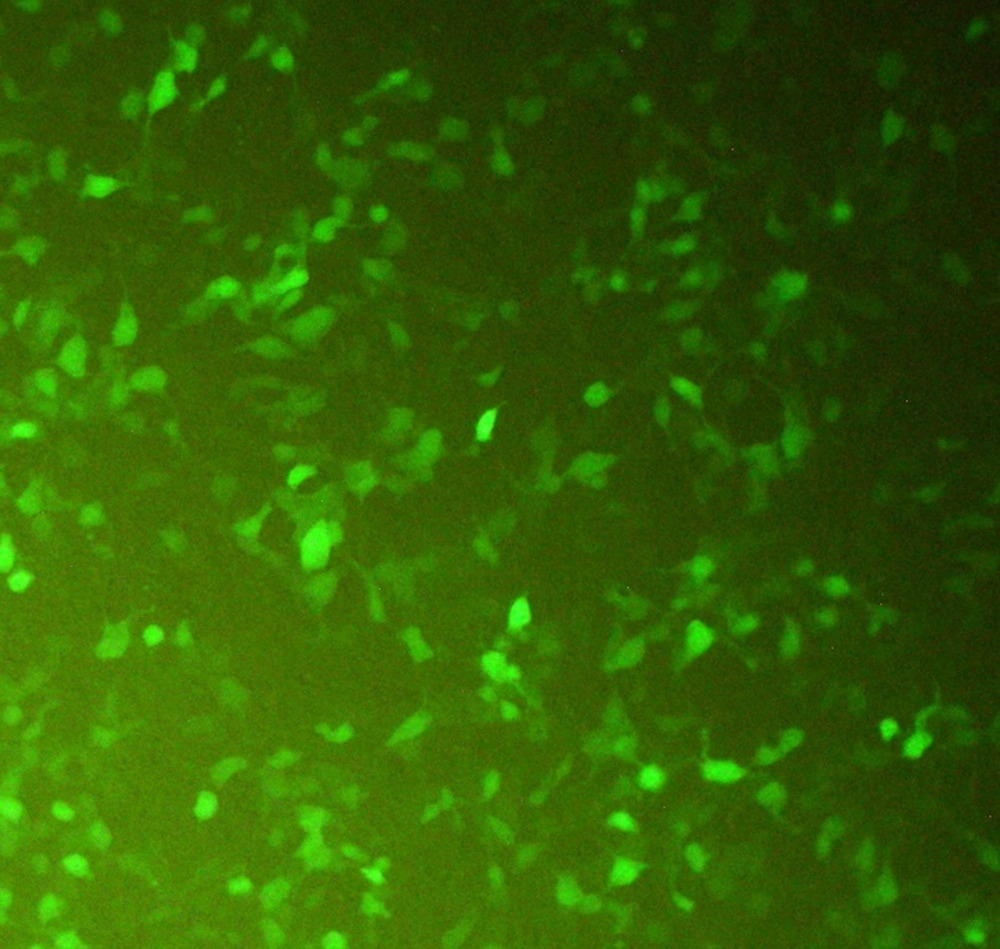 Transfected CHO-K1 cells with the GFP-expressing plasmid. The expression of GFP in the cytoplasm of the transfected CHO-K1 cell marks the cells green under fluorescence microscopy. The green cells represent the transfected cells with the GFP-expressing vector. Transfected CHO-K1 cells with the GFP-expressing plasmid. The expression of GFP in the cytoplasm of the transfected CHO-K1 cell marks the cells green under fluorescence microscopy. The green cells represent the transfected cells with the GFP-expressing vector.