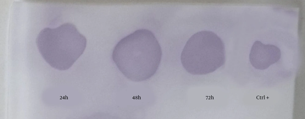 The dot blotting analysis of recombinant hIFN-β expressed by transiently transfected CHO-K1 cells. Supernatants were collected 24, 48, and 72 hours after transfection and subjected to dot blotting analysis using the mouse anti-hIFN-β primary antibody. The positive control was standard hIFN-β expressed by <i>Escherichia coli</i>. The dot blotting analysis of recombinant hIFN-β expressed by transiently transfected CHO-K1 cells. Supernatants were collected 24, 48, and 72 hours after transfection and subjected to dot blotting analysis using the mouse anti-hIFN-β primary antibody. The positive control was standard hIFN-β expressed by <i>Escherichia coli</i>.