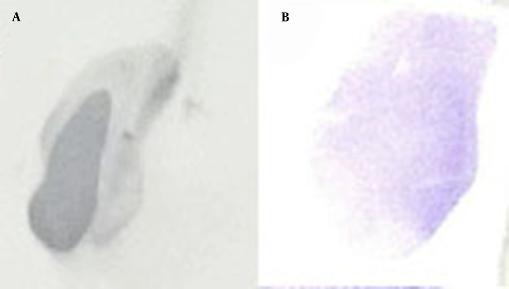 The dot blotting analysis of recombinant hIFN-β expressed by stably transfected CHO-K1 cells. Supernatants were collected from stably transfected CHO-K1 cells and subjected to dot blotting analysis using the mouse anti-hIFN-β primary antibody (B). Recombinant hIFN-β expressed by <i>Escherichia coli</i> was also used as a positive control (A). The dot blotting analysis of recombinant hIFN-β expressed by stably transfected CHO-K1 cells. Supernatants were collected from stably transfected CHO-K1 cells and subjected to dot blotting analysis using the mouse anti-hIFN-β primary antibody (B). Recombinant hIFN-β expressed by <i>Escherichia coli</i> was also used as a positive control (A).