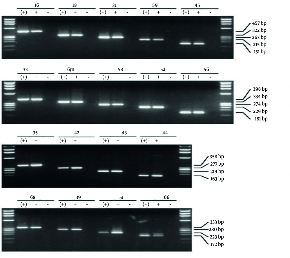The image illustrates the bands from reference samples used to determine the low-risk and high-risk human papillomavirus (HPV) genotypes. Genotyping was performed using the multiplex PCR method with 20 pairs of specific primers. Each sample was processed using four wells, and the obtained bands were compared with those of the reference samples shown in the figure to accurately identify the genotypes. The image illustrates the bands from reference samples used to determine the low-risk and high-risk human papillomavirus (HPV) genotypes. Genotyping was performed using the multiplex PCR method with 20 pairs of specific primers. Each sample was processed using four wells, and the obtained bands were compared with those of the reference samples shown in the figure to accurately identify the genotypes.