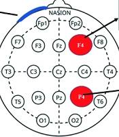 Comparison of the Effects of Transcranial Direct Current Stimulation (tDCS) and Super Brain Yoga on Balance and Balance Confidence in Inactive Elderly Individuals